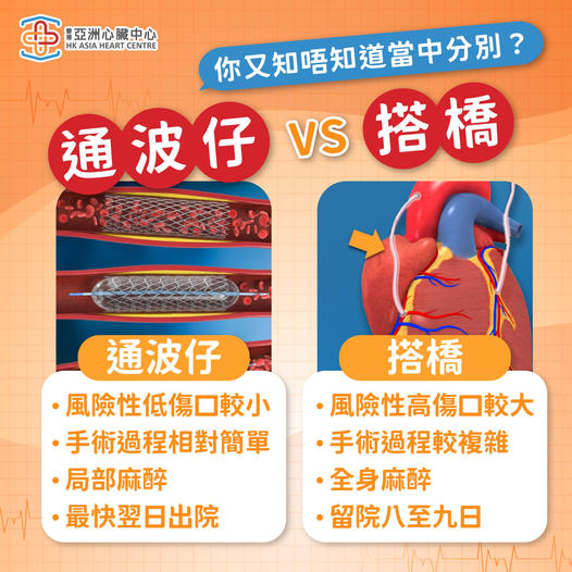 「通波仔」和「搭橋」的分別?