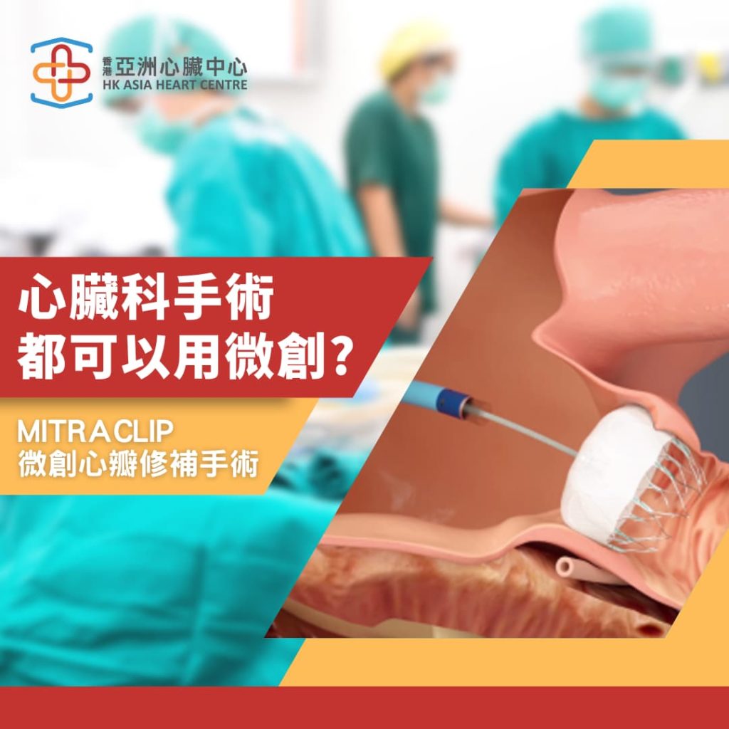心臟科手術都可以用微創？ 介紹Mitraclip微創心瓣修補手術