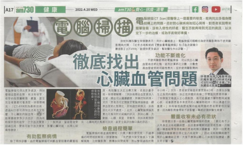 電腦掃描 徹底找出心臟血管問題