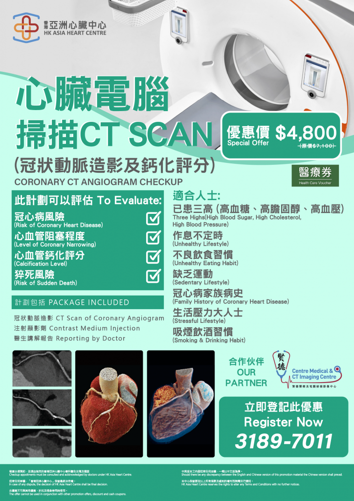心脏电脑扫描 (CT SCAN)